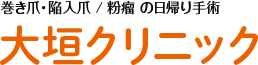 巻き爪・陥入爪 / 粉瘤 の日帰り手術
 大垣クリニック