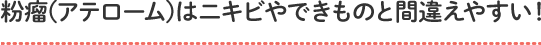 粉瘤(アテローム)はニキビやできものと間違えやすい！